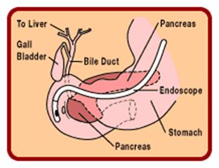 ERCP Procedure